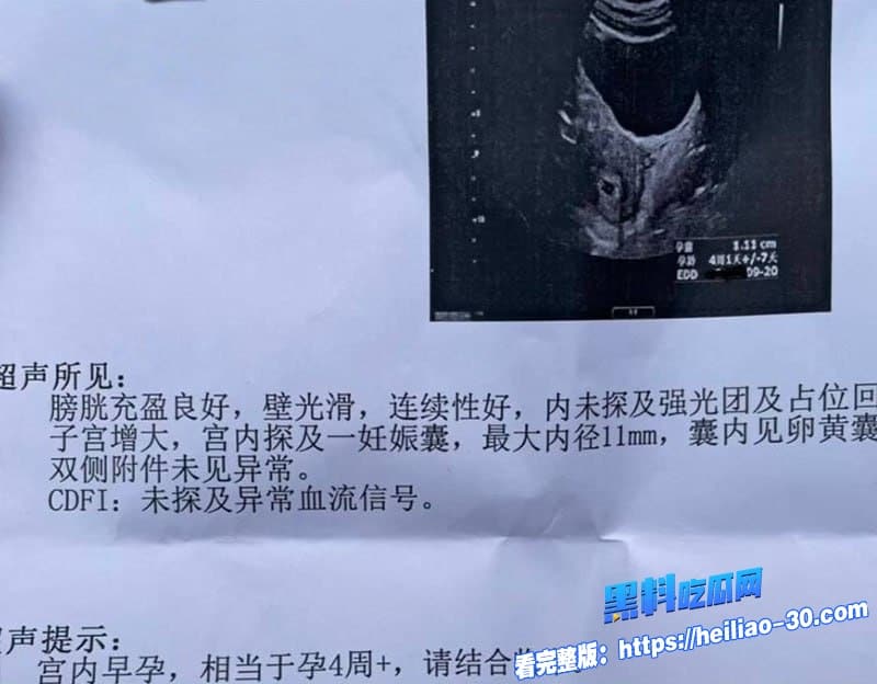 知名演员李沁被爆私生活混乱陪睡导演与杨洋邓伦雷军等人有染 多次堕胎每睡一次10万补偿震撼全网 26