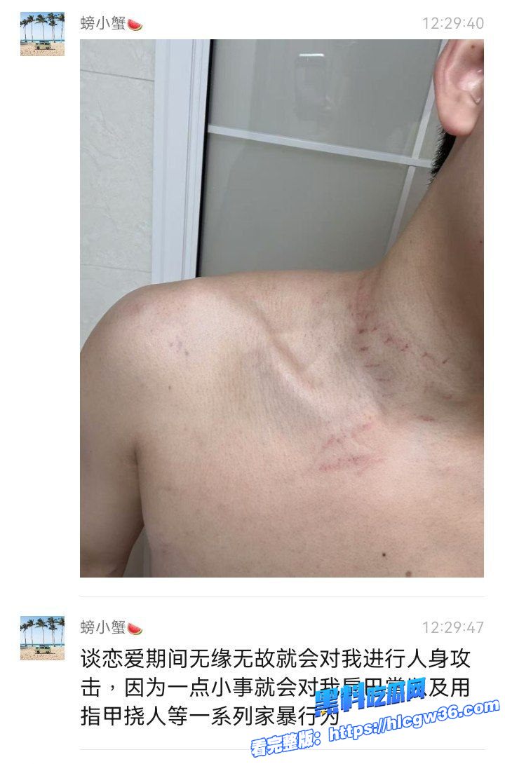厦门空姐艾淼被男友曝光是个圈钱拜金女出轨被抓恼羞成怒动手记录太炸裂男友直接曝光性爱视频 6 厦门空姐艾淼被男友曝光是个圈钱拜金女出轨被抓恼羞成怒动手记录太炸裂男友直接曝光性爱视频 6