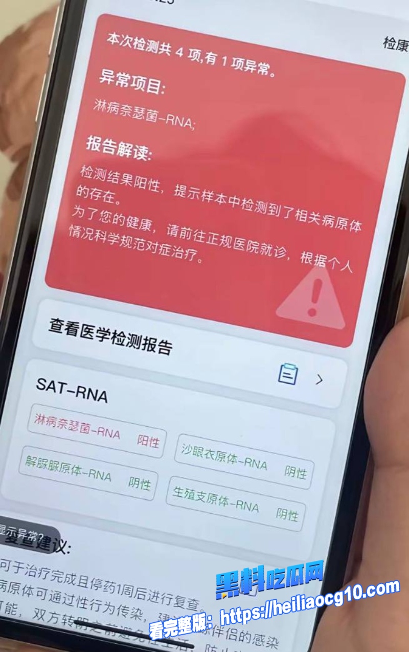 抖音网红王大根18 抖音网红王大根18