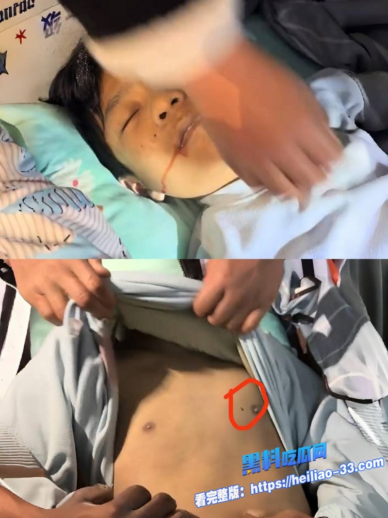 新蔡县今是清华园学校学生宿舍惨死嘴角血迹与胸口针孔疑点视频曝光网传钢管打人真相成谜3