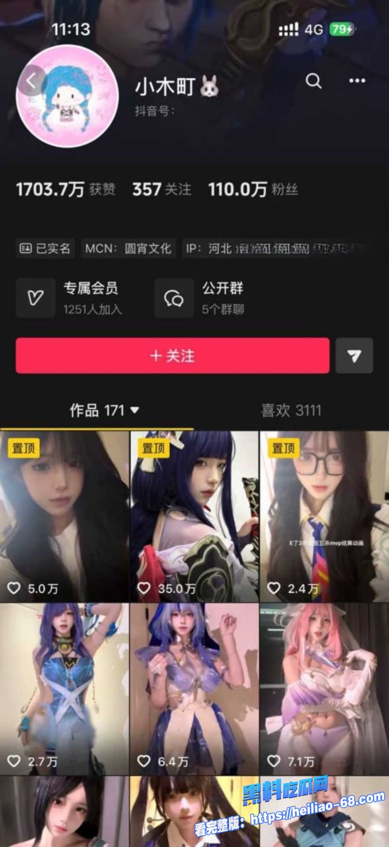抖音110万粉网红小木町私密视频流出娃娃脸雪白大奶彻底暴露1