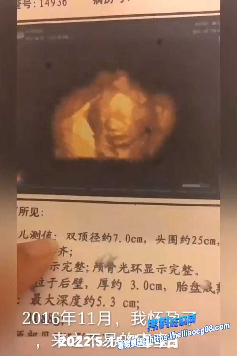 歌手海来阿木32 歌手海来阿木32