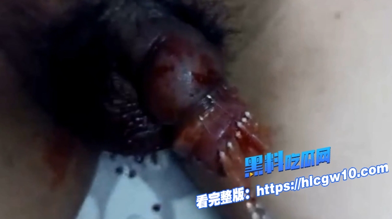 猎奇重口女王重度SM调教穿刺插马眼血腥虐阳男宠痛到发抖却十分满足4