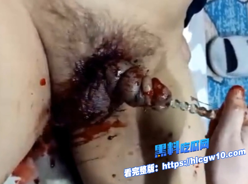 猎奇重口女王重度SM调教穿刺插马眼血腥虐阳男宠痛到发抖却十分满足8