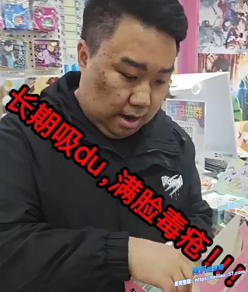 B站千万粉飞社长塌房实锤祖传诈骗加招嫖嗑药脸烂成毒疮嫖娼视频全网疯传5 B站千万粉飞社长塌房实锤祖传诈骗加招嫖嗑药脸烂成毒疮嫖娼视频全网疯传5