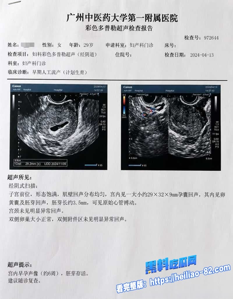 抖音700万粉贵阳二小姐塌房装清纯仙女私下偷已婚杰少生私生子被原配庄楚华实名锤烂 18
