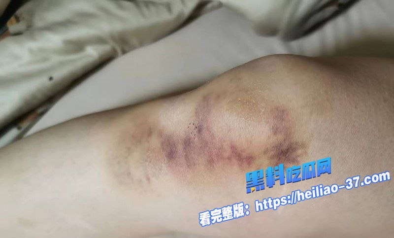 三门峡女网红娜姐重生大义灭亲曝光公职人员丈夫高飞家暴出轨女同事韩润19 三门峡女网红娜姐重生大义灭亲曝光公职人员丈夫高飞家暴出轨女同事韩润19