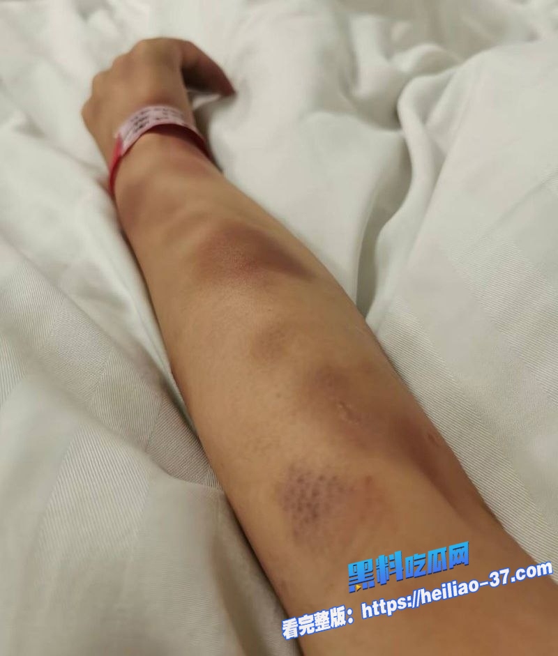 三门峡女网红娜姐重生大义灭亲曝光公职人员丈夫高飞家暴出轨女同事韩润20 三门峡女网红娜姐重生大义灭亲曝光公职人员丈夫高飞家暴出轨女同事韩润20