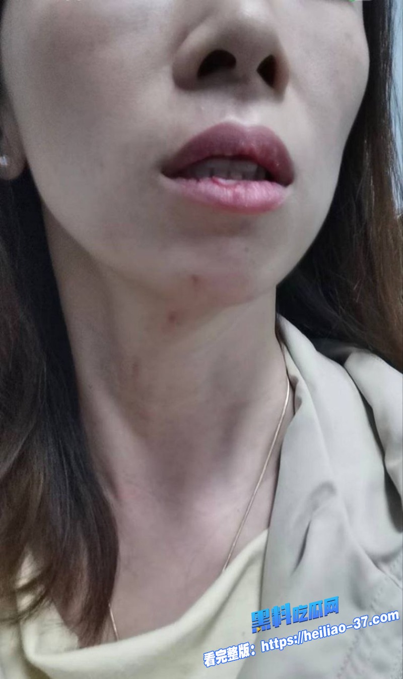 三门峡女网红娜姐重生大义灭亲曝光公职人员丈夫高飞家暴出轨女同事韩润21 三门峡女网红娜姐重生大义灭亲曝光公职人员丈夫高飞家暴出轨女同事韩润21