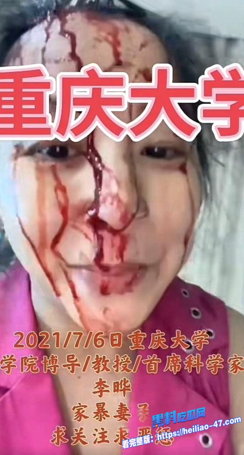 重庆大学医学院李晔聚众淫乱双向插头男扮女装男女通吃伙同谌小维 骗取国家科研奖金28 重庆大学医学院李晔聚众淫乱双向插头男扮女装男女通吃伙同谌小维 骗取国家科研奖金28