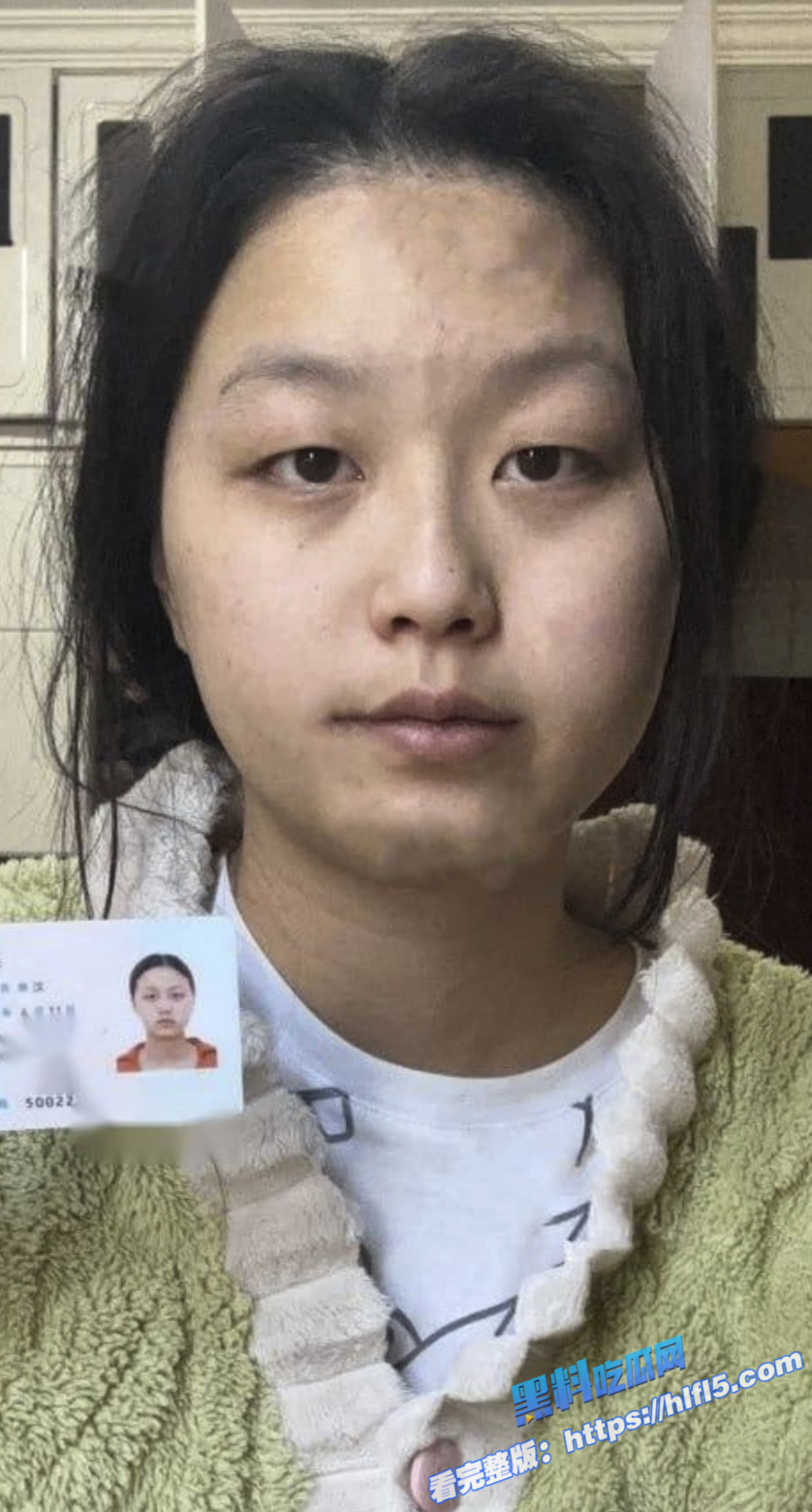 重庆精神小妹 莫盈 裸贷3000元 口叼内裤自慰视频曝光 满身皮肤病太惊悚！2