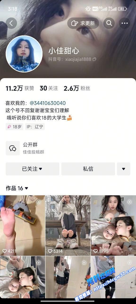 抖音00后微胖高颜值网红 小佳甜心 火辣自拍秀美脚长腿诱惑红唇 撩人身材一秒吸睛！图7