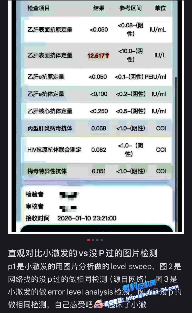 300万抖音伪娘网红起床了小澈复播惊现抗HIV药物早期男男旧床照随之曝光社死现场拉满 15 300万抖音伪娘网红起床了小澈复播惊现抗HIV药物早期男男旧床照随之曝光社死现场拉满 15