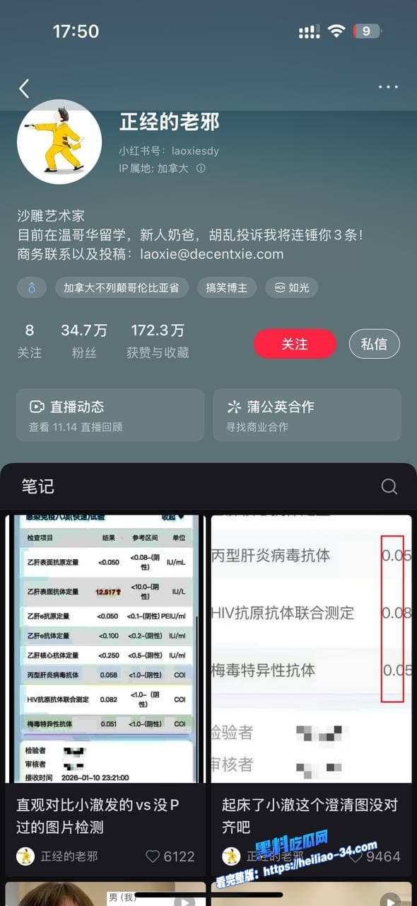 300万抖音伪娘网红起床了小澈复播惊现抗HIV药物早期男男旧床照随之曝光社死现场拉满 17 300万抖音伪娘网红起床了小澈复播惊现抗HIV药物早期男男旧床照随之曝光社死现场拉满 17