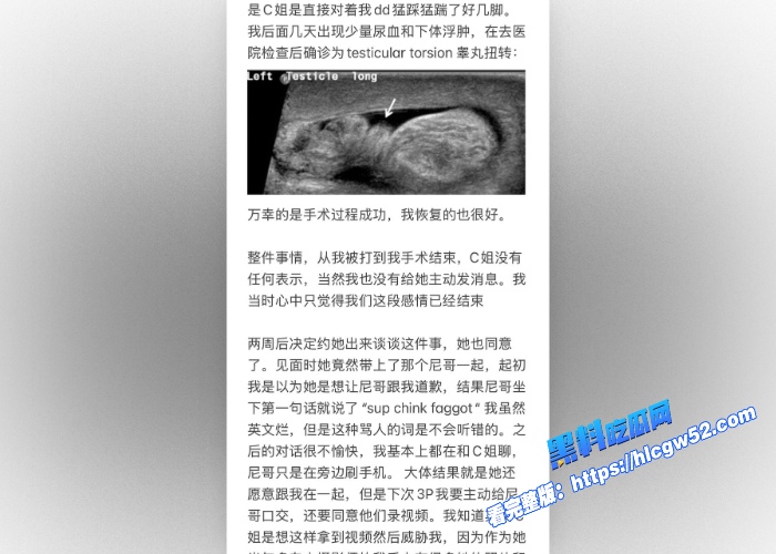 美国留学生Caroline黑屌收割机约黑人玩绿帽奴3P让尼哥射男友一脸反抗时踢爆男友睾丸野战视频被流出 图8WH700x500px 美国留学生Caroline黑屌收割机约黑人玩绿帽奴3P让尼哥射男友一脸反抗时踢爆男友睾丸野战视频被流出 图8WH700x500px