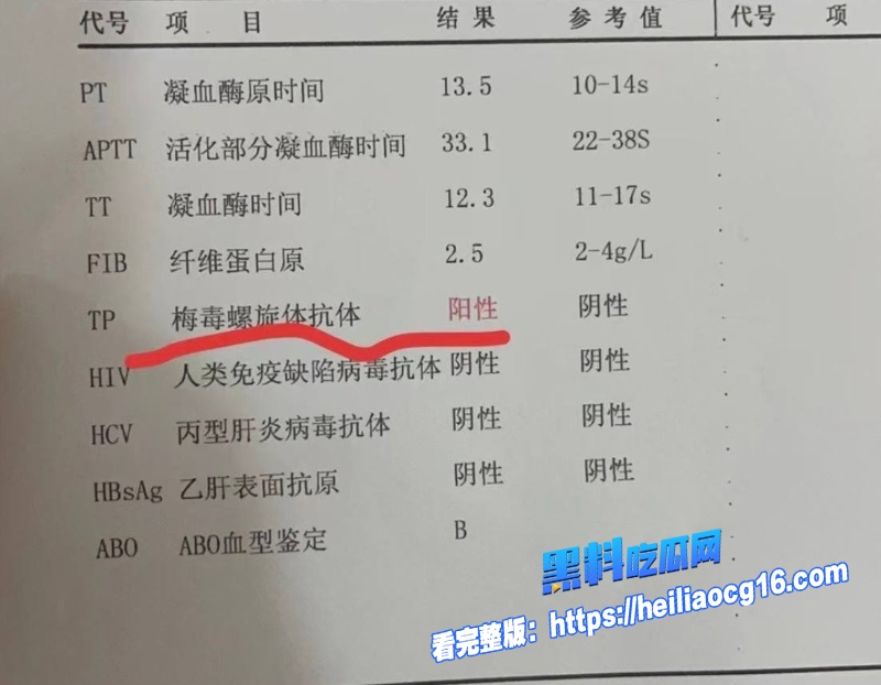 抖音网红杨洁31
