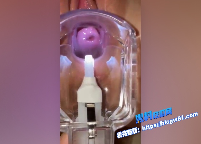 呦呦萝莉少女cvc7700被金主嫩穴扩阴器全程录制小穴视频流出子宫清晰可见无毛白虎小穴该说不说真是太粉了 图11