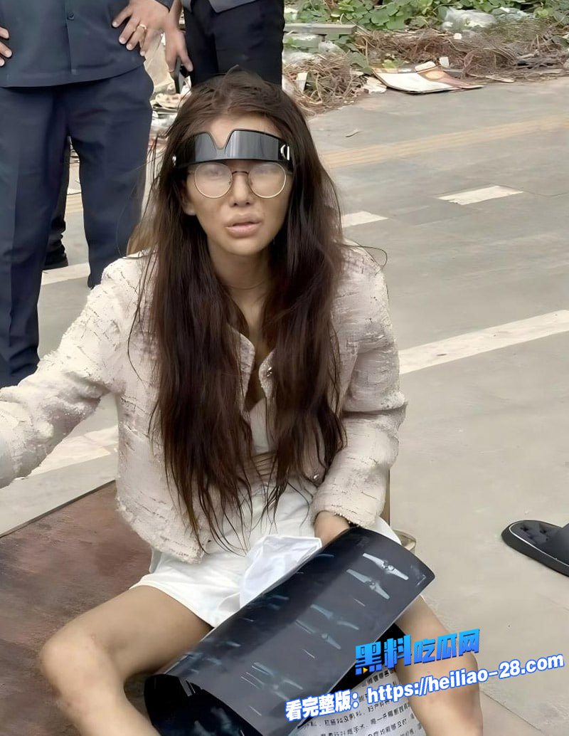 昔日顶美网红umi如今流浪在柬埔寨街头疯癫如大妈原因竟是遭渣男诱骗吸毒后遭抛弃11