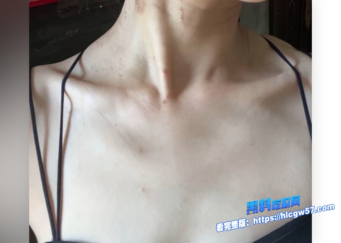 抖音女网红轮滑冰姑娘私下竟是生化母体携带艾滋病下海卖淫感染超千人性爱视频曝光引其嫖娼界惊慌 图21 抖音女网红轮滑冰姑娘私下竟是生化母体携带艾滋病下海卖淫感染超千人性爱视频曝光引其嫖娼界惊慌 图21