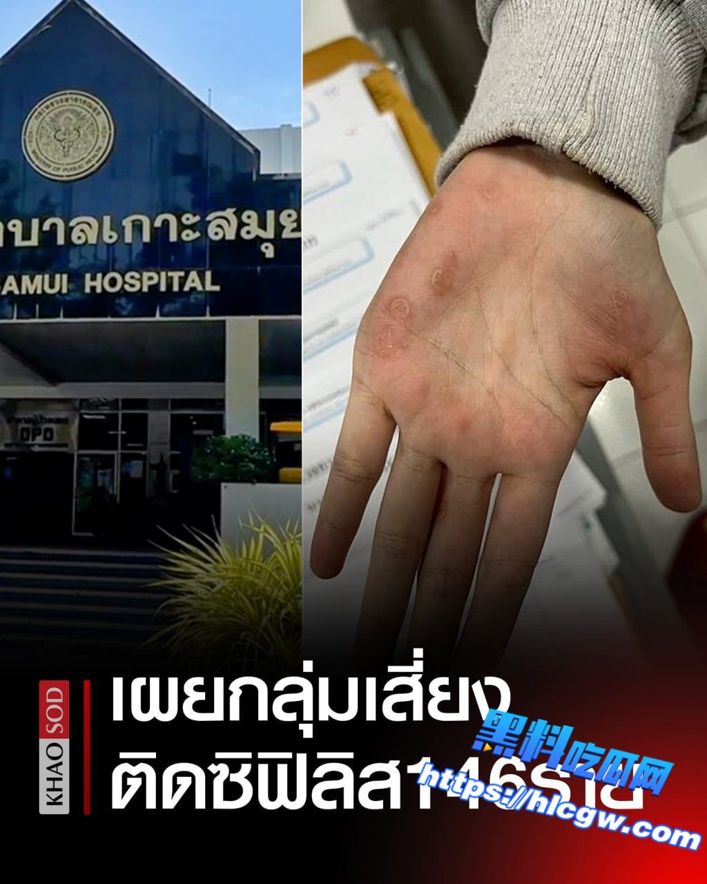 外国人居多!泰国苏梅岛“梅毒”感染情况令人担忧!01 外国人居多!泰国苏梅岛“梅毒”感染情况令人担忧!01
