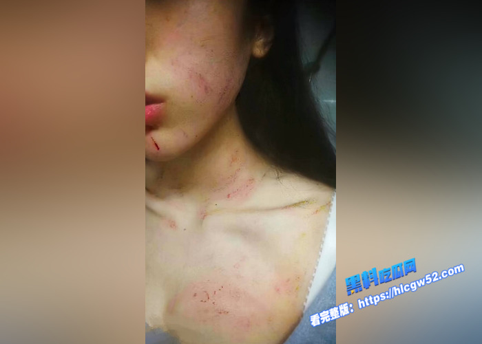 抖音160万粉丝网红 长不大的瓜哥 被老婆实名举报家暴 出轨女粉丝 口交性爱视频被曝光4