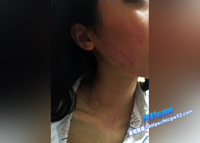 抖音160万粉丝网红 长不大的瓜哥 被老婆实名举报家暴 出轨女粉丝 口交性爱视频被曝光7