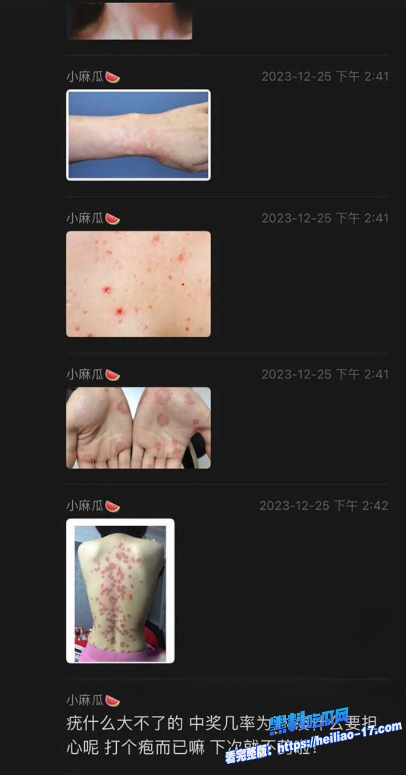 和平精英福寿萝事件生化母体拿捏国服镜梅毒艾滋四合一女陪玩线下报复酒店双排视频流出感染多名主播！ 18