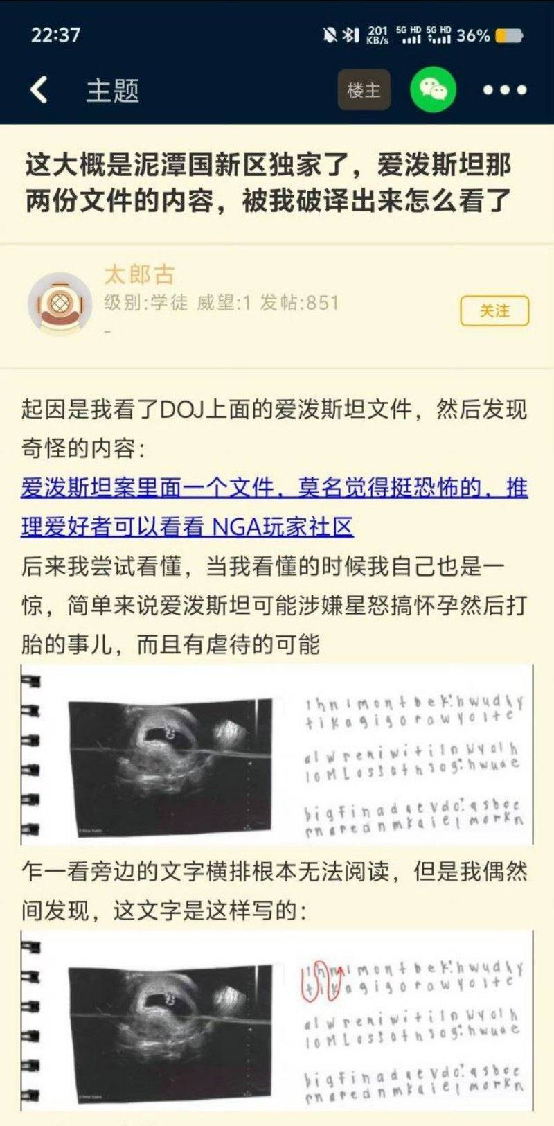 爱泼斯坦案终极后续5 爱泼斯坦案终极后续5