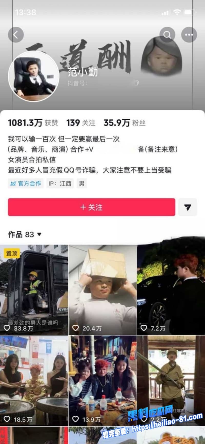 当年爆红的小马云范小勤彻底长歪成精了被曝光到处狂加小姐姐裸聊马云同款脸如今成了最大笑柄1