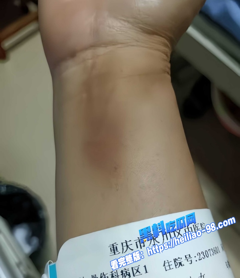 重庆53岁妻子王作红遭丈夫何家勇长期家暴出轨1400万财产被藏离婚案全网关注3