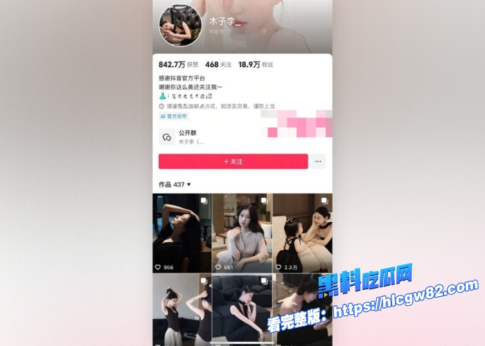 抖音高颜值模特网红木子李与富二代酒店约炮视频曝光男主一边看比赛一边让女主口交内射清纯的外表下私下这么快活 图1 抖音高颜值模特网红木子李与富二代酒店约炮视频曝光男主一边看比赛一边让女主口交内射清纯的外表下私下这么快活 图1