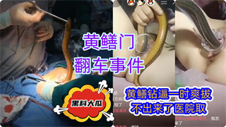 黄鳝门翻车事件直播黄鳝插逼医院取 封面