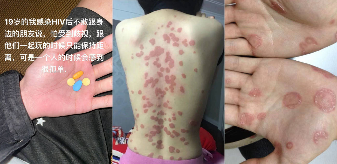 国服镜 抖音寂寞的海 线下操粉遇到生化母体 艾滋梅毒淋病加hpv四合一 线下被单杀!
