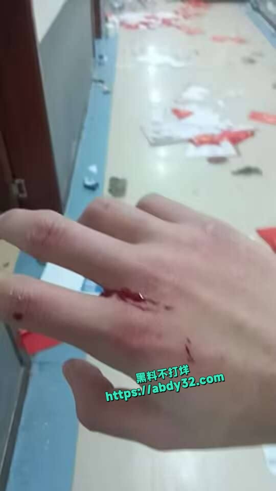 山东环帝网瘾戒除学校学生暴动 9