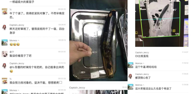50岁了还玩这么花!大爷为寻求刺激,将30cm茄子插入肛门 无法取出 医护人员都惊呆