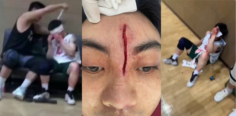 广州汇悦台一男子球品太差拿球爆头对方!额头上鲜血直流,这一肘击直接干芭比Q了!