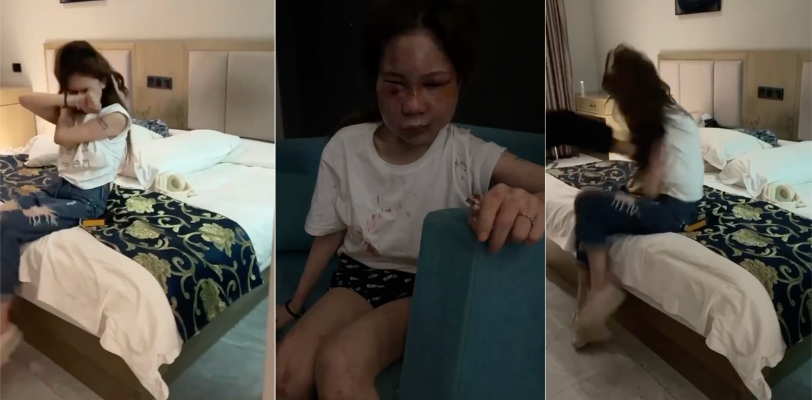 谭竹匆忙逃离重庆 网落流传被外网悬赏200W取谭竹人头 谭竹被打成猪头视频照片 真假自辨!