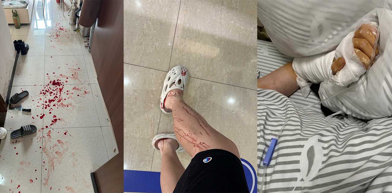 逆天!B站up主被女友家暴狂砍十几刀 小仙女母亲带人上门称不谅解就告男方强奸