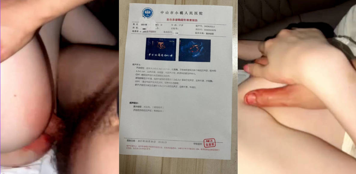 玛德BBQ了!闯了个“红灯”结果女友黄体破裂!怎么办?小榄人民医院你是认真的么?
