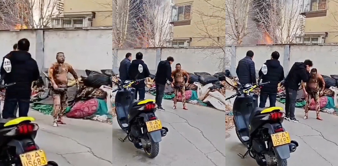 山东一小区发生火灾 一男子严重烧伤逃出形似丧尸 不要玩火自焚!