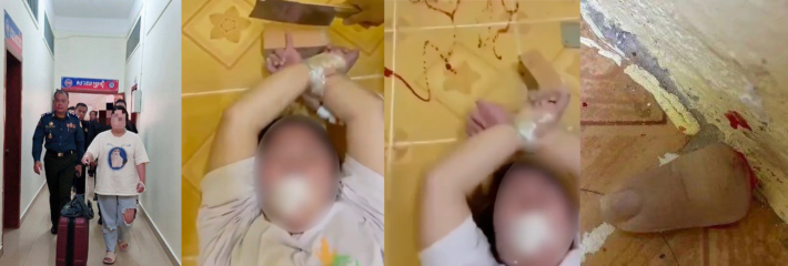 「重口勿入」 柬埔寨绑架华人事件 中国女同胞在柬埔寨被绑架砍手指恐怖视频,可惜不能再用小指头抠鼻屎了