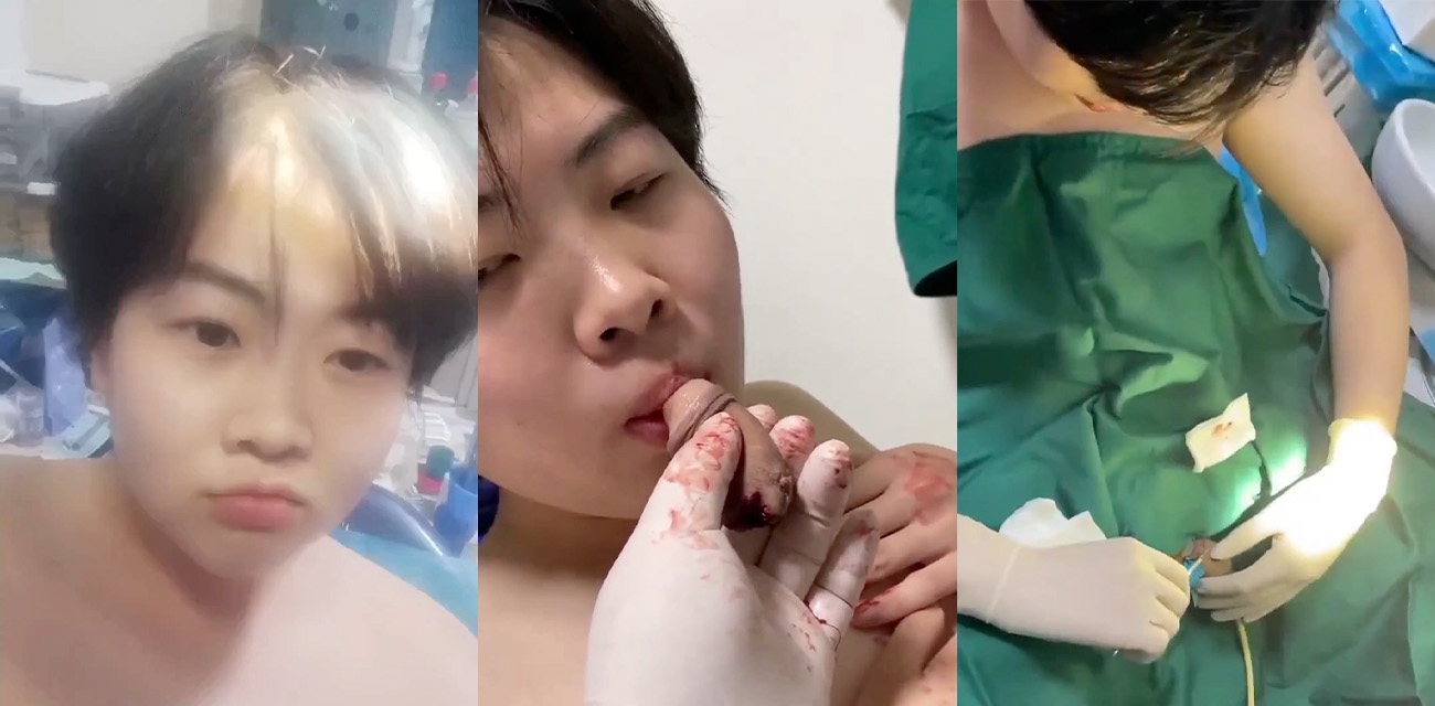男子为了自己给自己口交 竟然切下自己的鸡巴放嘴里吮吸 胆小勿看!