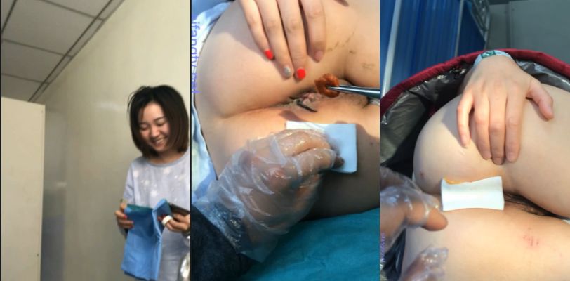 【医院泄密】内部教学给女痔疮患者换药过程!