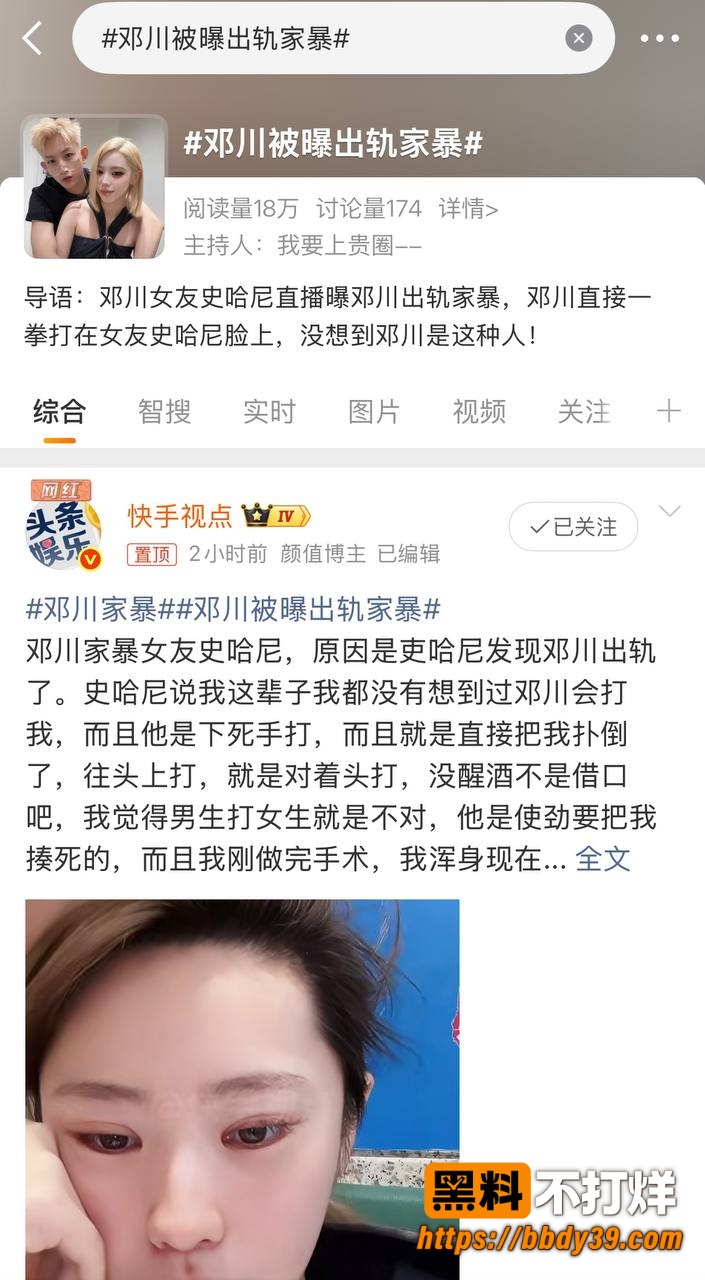 邓川家暴出轨1