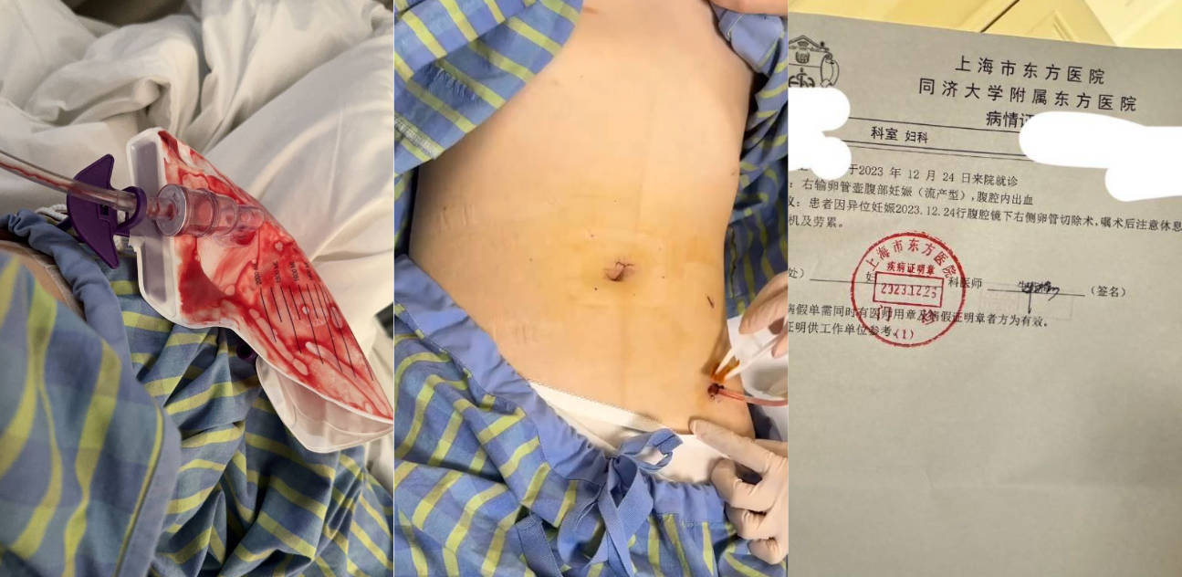 避雷!长沙男模加凡 本名韩飞 江苏南通人 以恋爱为由骗走几十万 导致我宫外孕~