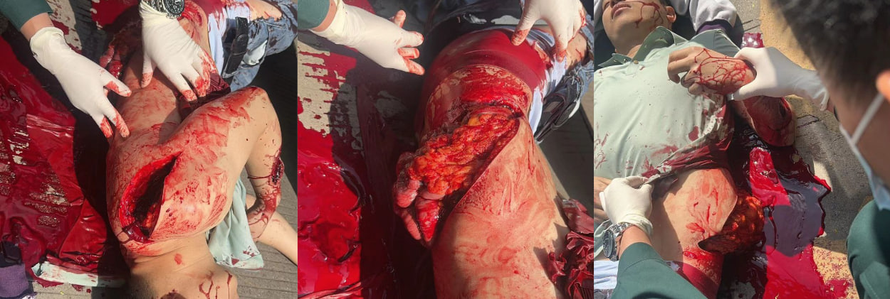 血腥程度堪比鬼片!云南开远一男子因情人节玩别人老婆被发现后爆砍!