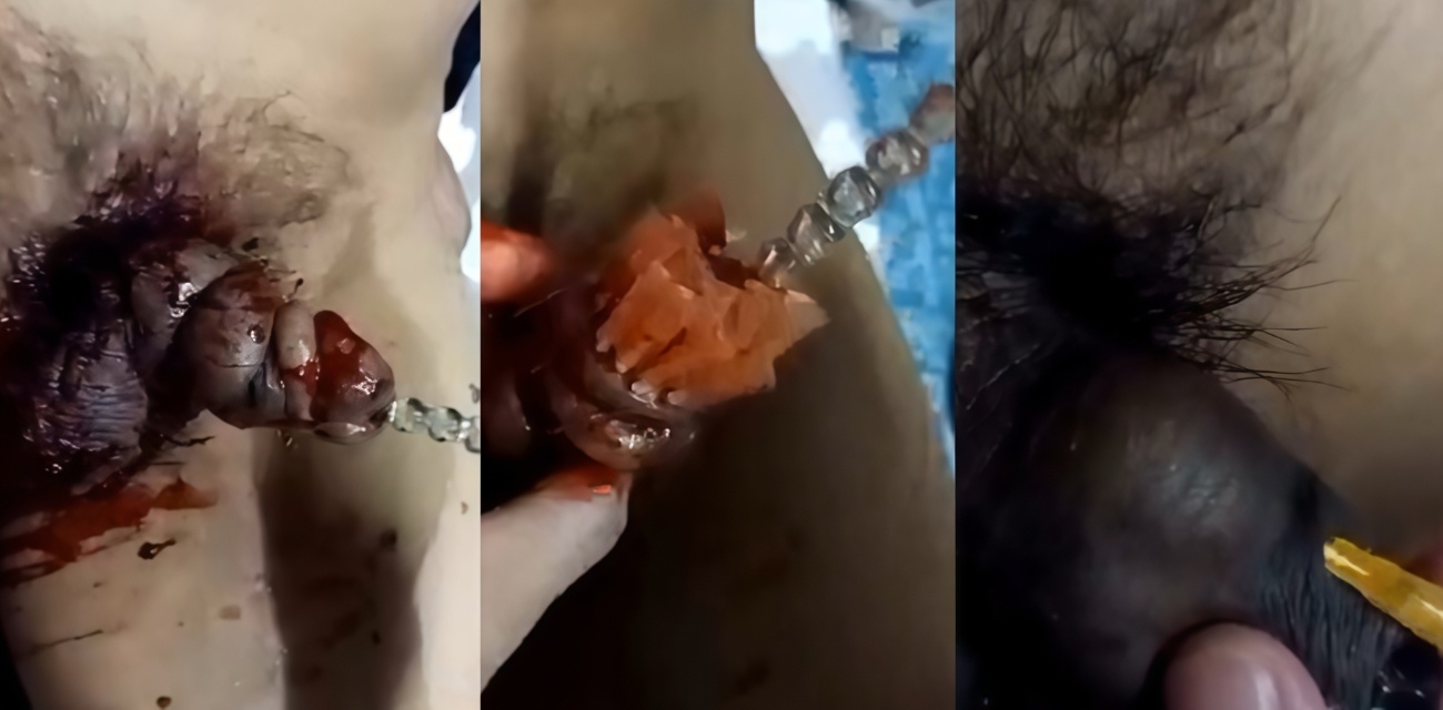 猎奇重口 女王重度SM调教穿刺插马眼血腥虐阳 男宠痛到发抖却十分满足！
