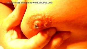 乳头穿刺