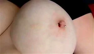 乳头穿刺